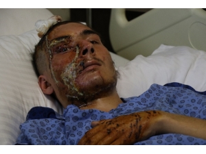 Bu Halde Hastaneden Taburcu Edildi, Ailesi Gözyaşına Boğuldu