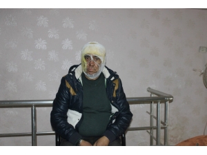 Evinde Çıkan Yangını Söndürmek İsterken Yaralandı