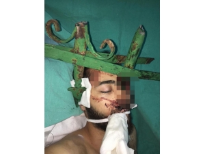 Antalya’da Gencin Yüzüne Saplanan Demir Çubuk Güçlükle Çıkarıldı