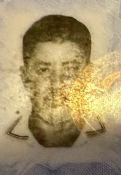 kadin-doktorun-sedye-uzerindeki-kalp-masajiyla-hayata-tutunmustu-bir-gun-yasayabildi