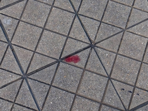 Küçük Çocuk Arkadaşını Valilik Önünde Çakıyla Yaraladı