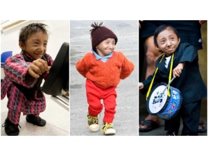 Dünyanın En Kısa Adamı 28 Yaşında Hayatını Kaybetti