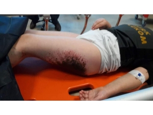 Kartopu Oynarken Yanan Çocuklara Doku Nakli Yapılacak