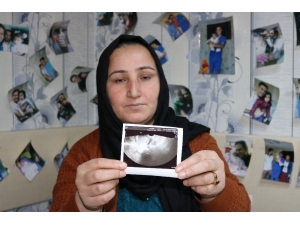 Yumurta Ve Rahim Gençleştirme Tedavisiyle 12 Yıllık Çocuk Hasreti Son Buldu