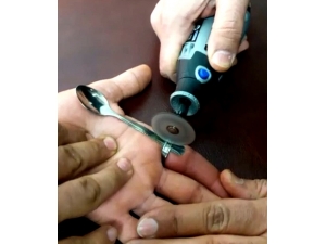 Yüzüğe Sıkışan Parmağı İtfaiye Kurtardı