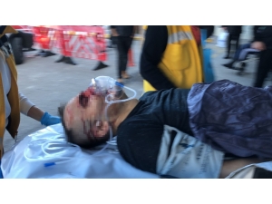 Tartıştıkları Vatandaşı Önce Darp Edip Sonra Pompalı Tüfekle Yaraladılar