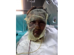 ’Yüzüme Kızgın Yağ Attı’ Demişti, İlk Duruşmada İfade Değiştirdi