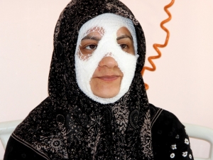 Bomba Gibi Patlayan Düdüklü Tencere Genç Kadına Dehşeti Yaşattı