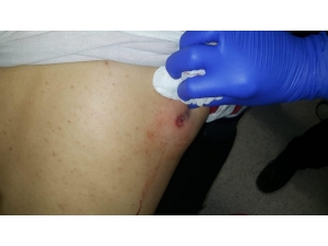 Yunan Güvenlik Güçleri Mültecilere Ateş Açtı: 1 Ölü, 5 Yaralı