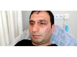 Erzincanspor Yöneticileri Gazeteciyi Döverek Hastanelik Etti