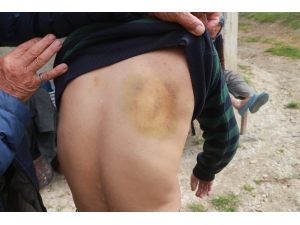 Mut’ta Engelli Genç Darp Edildi