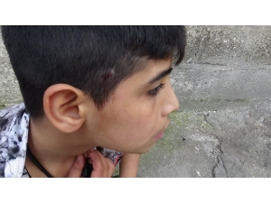 Diyarbakır’da Silahlı Kavgada Top Oynayan Çocuk İle Birlikte 3 Kişi Yaralandı