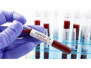 Koronavirüsün Medya Karnesi Çıkarıldı