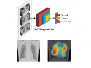 Korona Virüs Teşhisini Kolaylaştıracak Yapay Zeka Sistemi