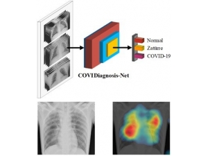 Yapay Zeka İle Korona Virüs Teşhisi