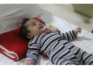 Suriyeli Yusuf Bebek Türkiye’de Tedavi Ediliyor