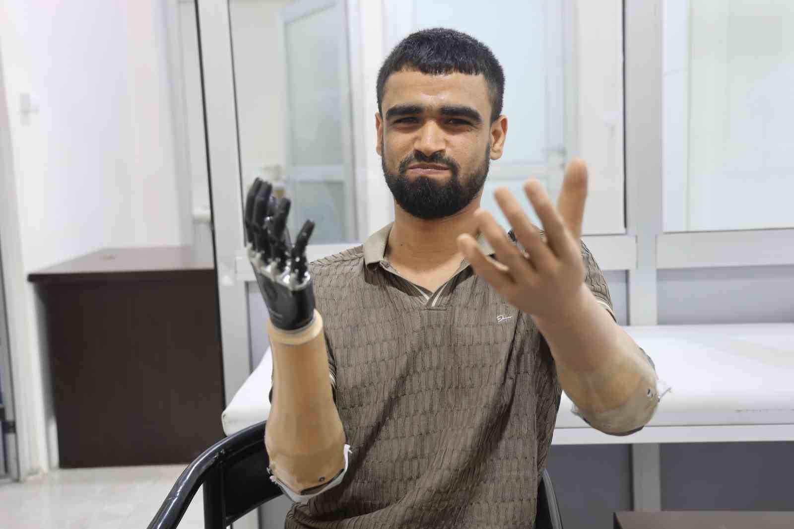 demirin-elektrik-tellerine-degmesiyle-hayati-kararan-muhammed-3-milyon-tl-degerindeki-protez-bacagina-ve-2-biyonik-koluna-kavustu