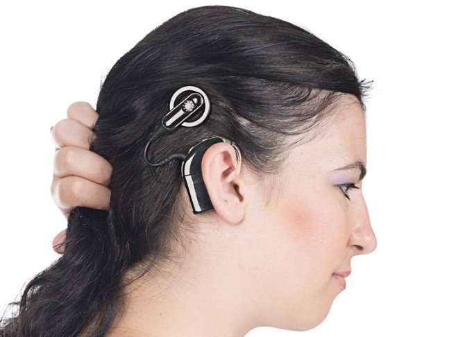 Adana’da İlk Biyonik Kulak Ameliyatı