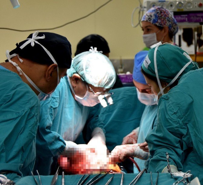 14 yaşındaki Çocuktan 3.6 Kilo Tümör Çıkartıldı