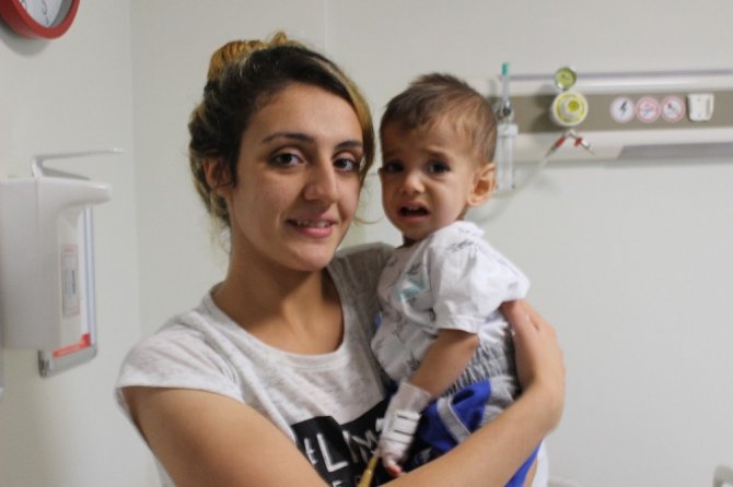 Gaziantep’te Yemek Borusu Olmayan Bebeğin Midesi Yukarı Çekildi