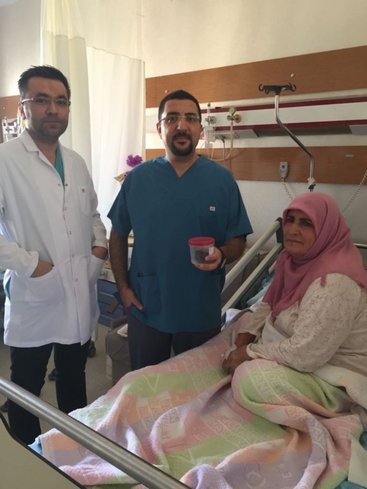 Safra Kesesinden 10 Santimetrelik Taş Çıkarıldı