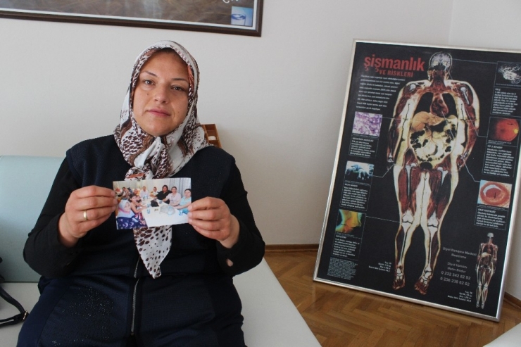 Sadece Diyetle Bir Yılda 76 Kilo Verdi