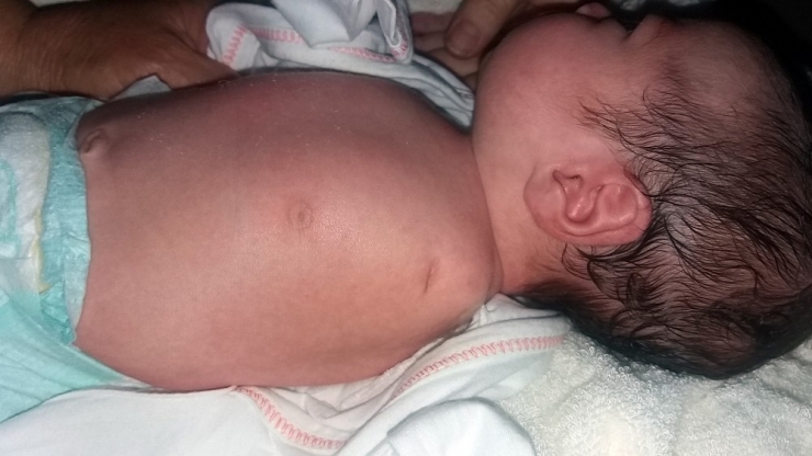 ’Sağlıklı’ Dediler, Kolsuz Doğdu