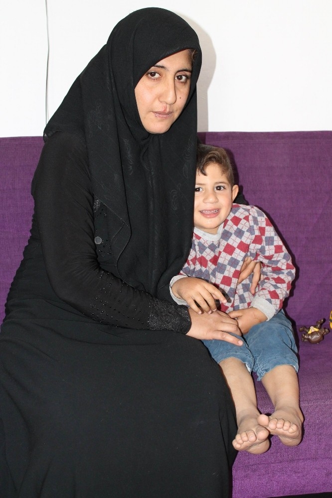 Savaşın Çocuğu 3 Yaşında 3 Kez Kalp Ameliyatı Oldu