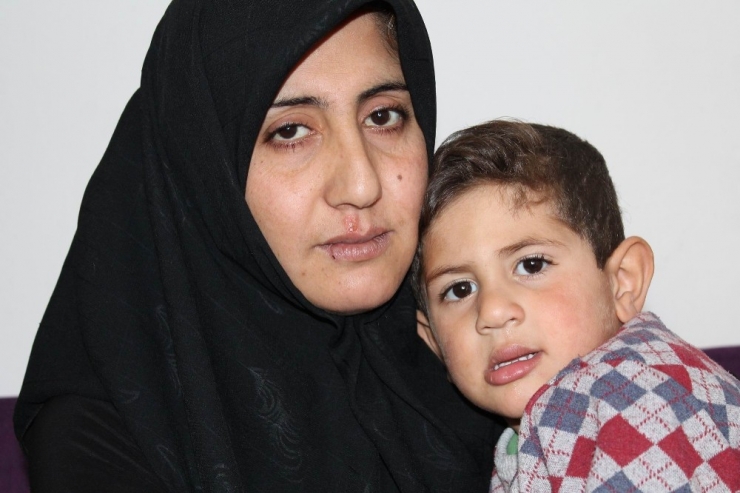 Savaşın Çocuğu 3 Yaşında 3 Kez Kalp Ameliyatı Oldu