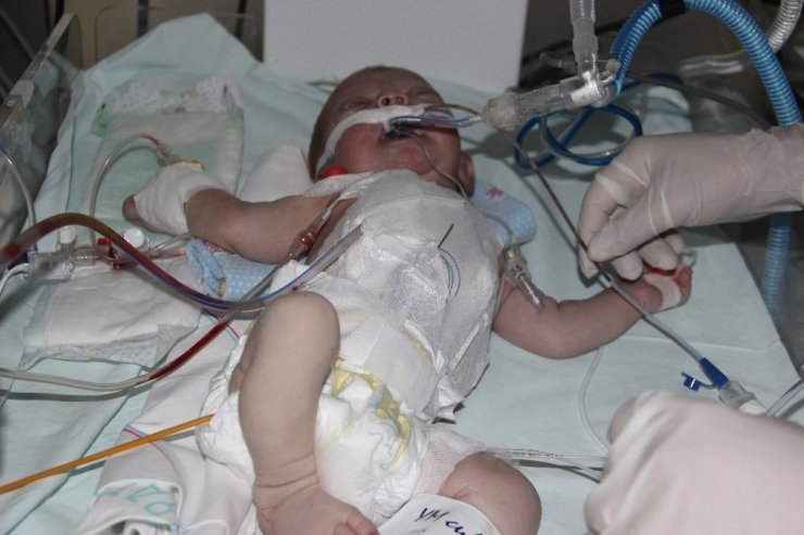 Suriyeli Bebeğin Kalbinin Yarısı Çalışmıyor