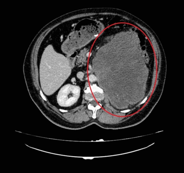 Dünyada İkinci Kez Rastlanan Vaka Doktorları Bile Şaşırttı