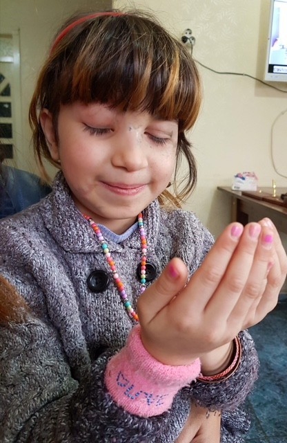 Keskin Nişancıların Gözünden Vurduğu Şeyma’nın Umudu 50 Bin Tl