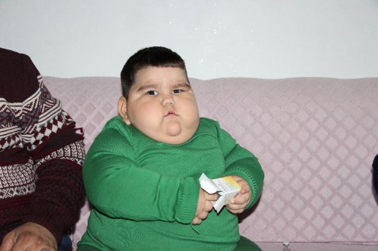 2 Yaşında 37 Kilo Olan Yağız Bebek İlacına Kavuştu
