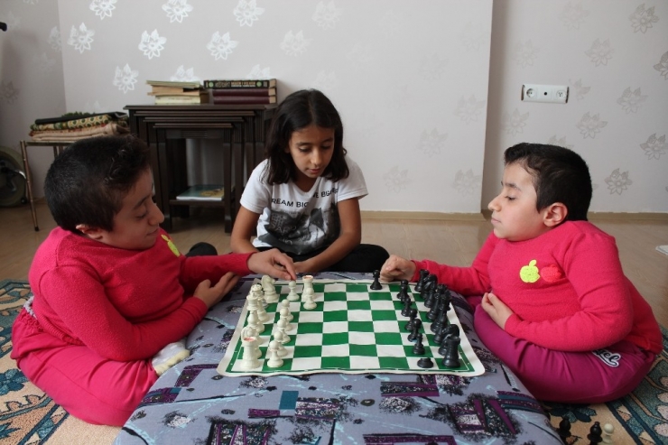 Cam Kemik Hastası İkizlerden Birinin Kemiği Kırılınca Diğeri De Hissediyor