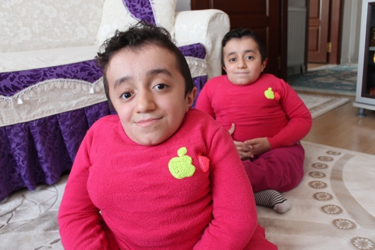 Cam Kemik Hastası İkizlerden Birinin Kemiği Kırılınca Diğeri De Hissediyor