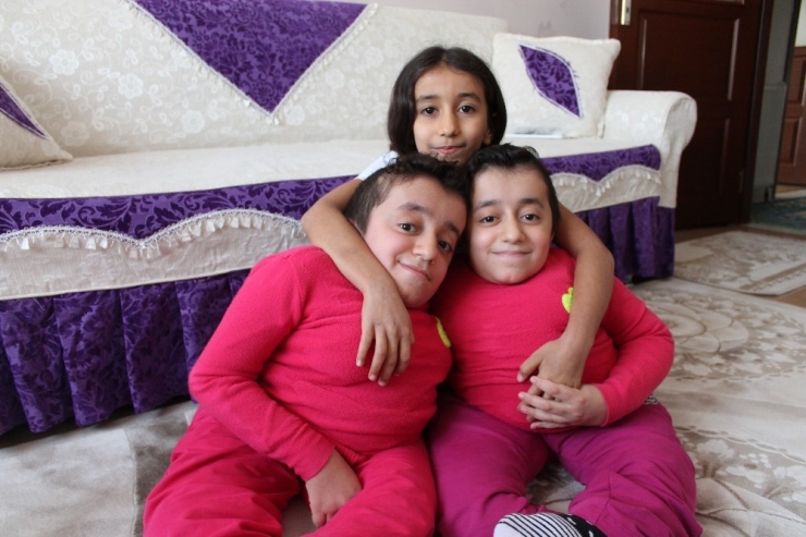 Cam Kemik Hastası İkizlerden Birinin Kemiği Kırılınca Diğeri De Hissediyor