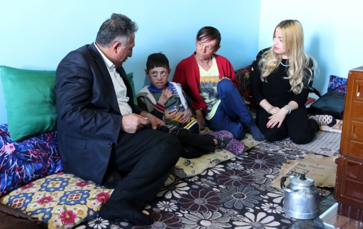 Kelebek Hastası Çocuklara Yardım Eli