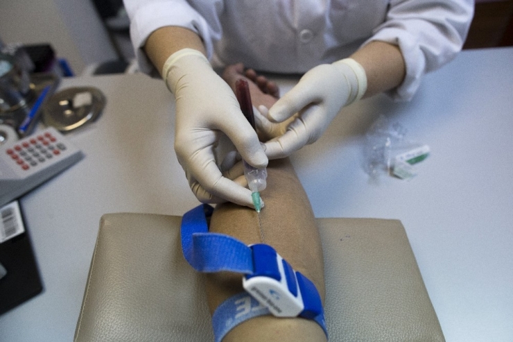 Aıds’e Bağlı Ölümler Azaldı