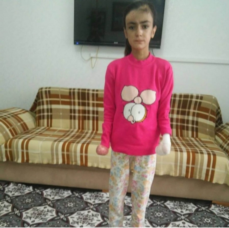 Antep’teki Kelebek Çocuğa Diyarbakır’dan Yardım