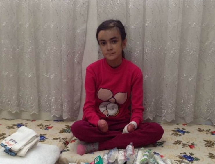 Antep’teki Kelebek Çocuğa Diyarbakır’dan Yardım