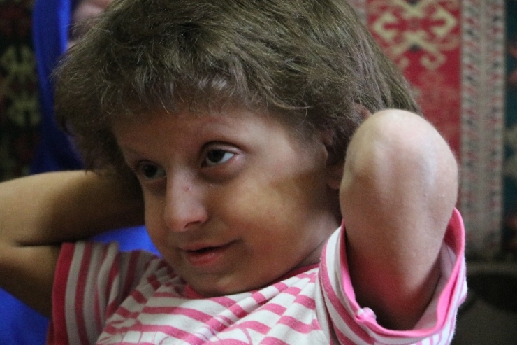 5 Yıldır Karaciğer Nakli Bekleyen Minik Derya’nın Feryadı