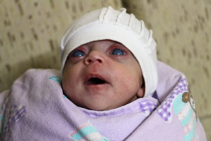 Minik "İkranur" Görmek İçin Destek Bekliyor