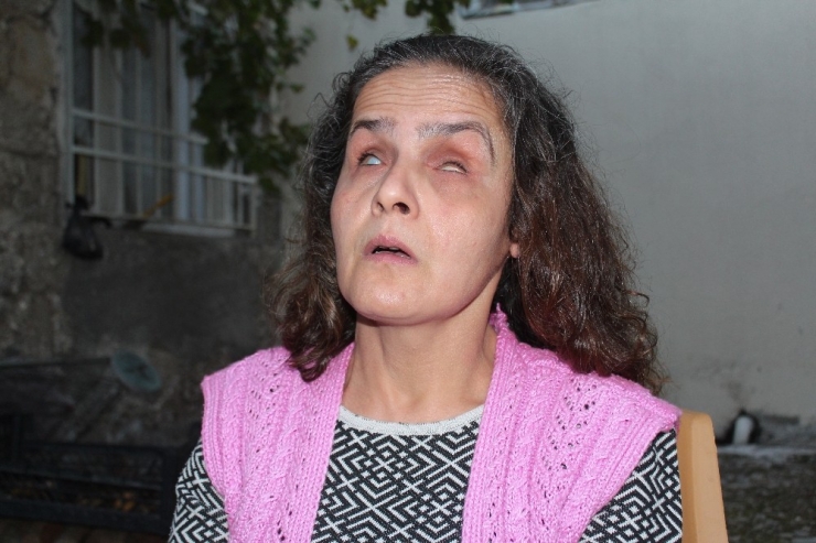 Bir Taşla Dünyası Karardı