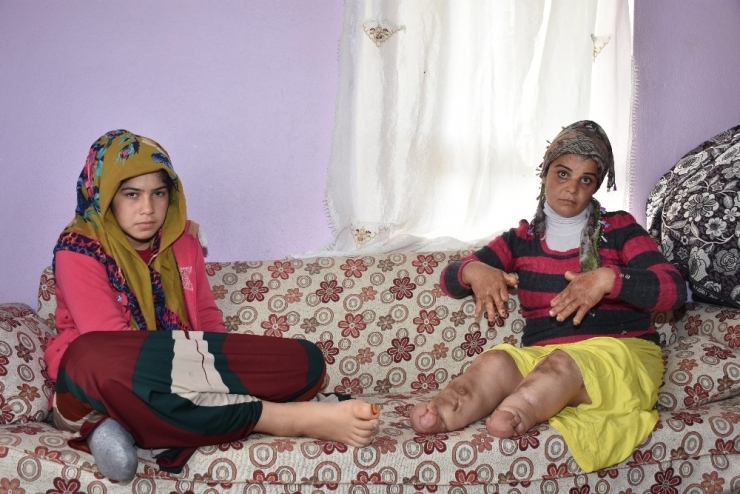 Elleri Ve Kolları Her Geçen Gün Eriyor