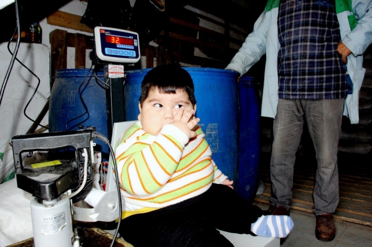 Yağız Bebek 41 Günde 5 Kilo Verdi
