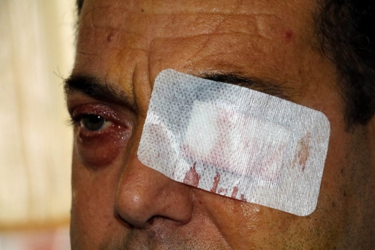 Yüzde 90 Görme Engeli Bulunan Şahıs Emeklilik Bekliyor