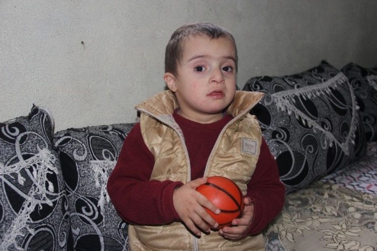 Down Sendromlu, Kalbi Delik Ve Guatr Hastası