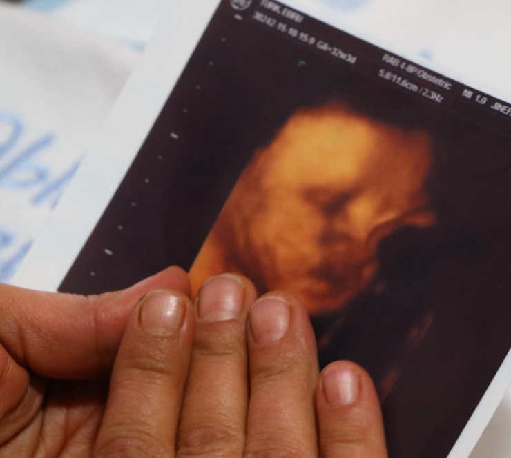 Terör Gazisinin Bebeğinin Ölümüyle İlgili ’İhmal’ İddianamesi Kabul Edildi