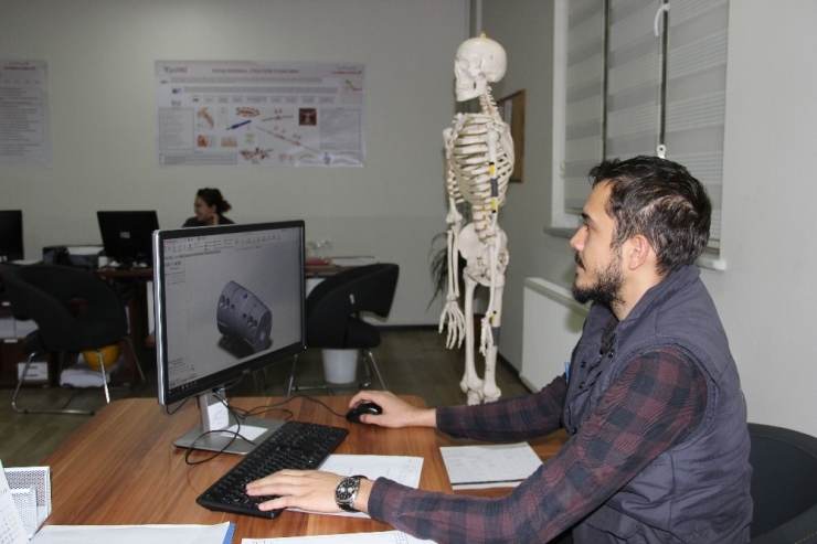 Kam Milinden Tümör Protezine