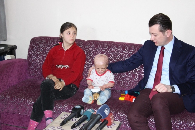 2 Yaşındaki Ahmet’in Yaşaması 170 Binin Bulunmasına Bağlı